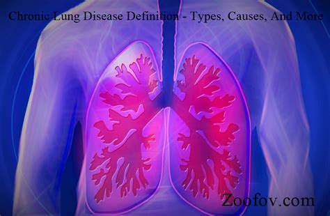 Chronic Lung Disease Definition Types Causes And More