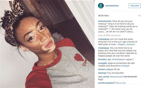 Winnie Harlow No Makeup Brisia Blog