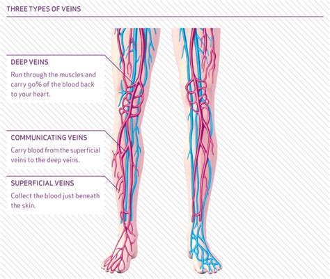Overview And Symptoms Of Varicose Veins • The Vein Centre Auckland