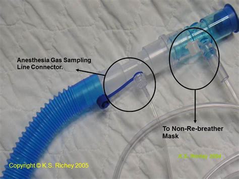 Fremitus Inhaled Nitric Oxide Set Up For Nitric Oxide Challenge