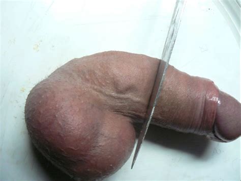 Penis Cut Off Balls Cock Hot Sex Picture