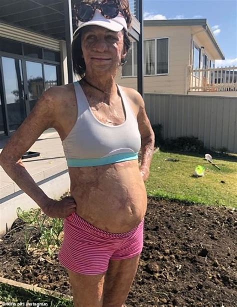 Turia Pitt Shows Off Her Growing Baby Bump During A Relaxing Day Out At The Beach Daily Mail