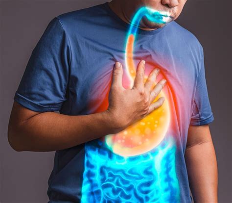 Heartburn Symptom In Singapore Causes Treatments And More Gutcare