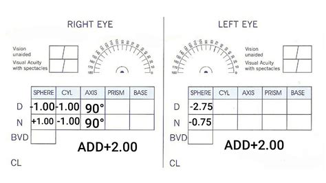 Eyes Vision Eye Test Online Nz Glasses Prescription To Contacts Chart
