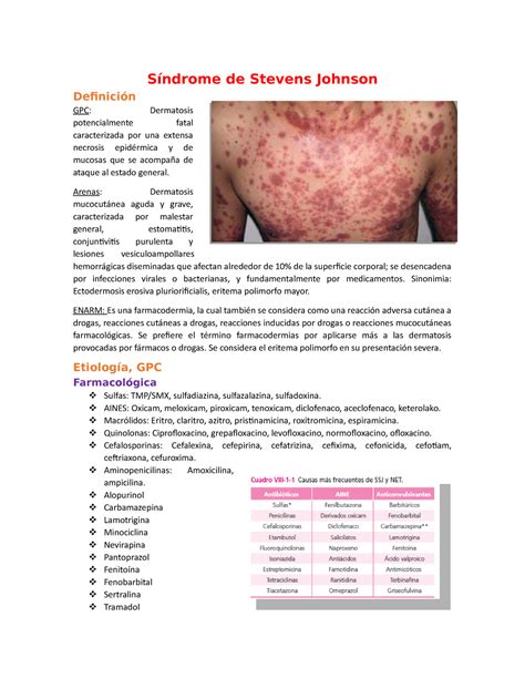 Síndrome Stevens Johnson De Stevens Johnson Gpc Dermatosis