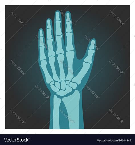 X Ray Shot Wrist Human Body Bones Hand Royalty Free Vector