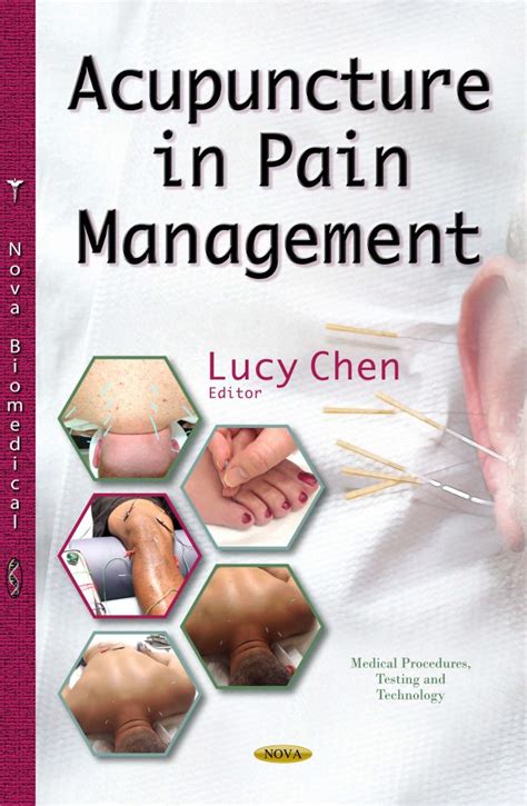Acupuncture In Pain Management Nova Science Publishers