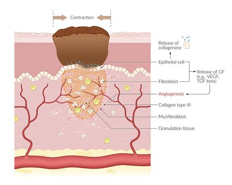 Granulation Tissue Wound Healing Stages