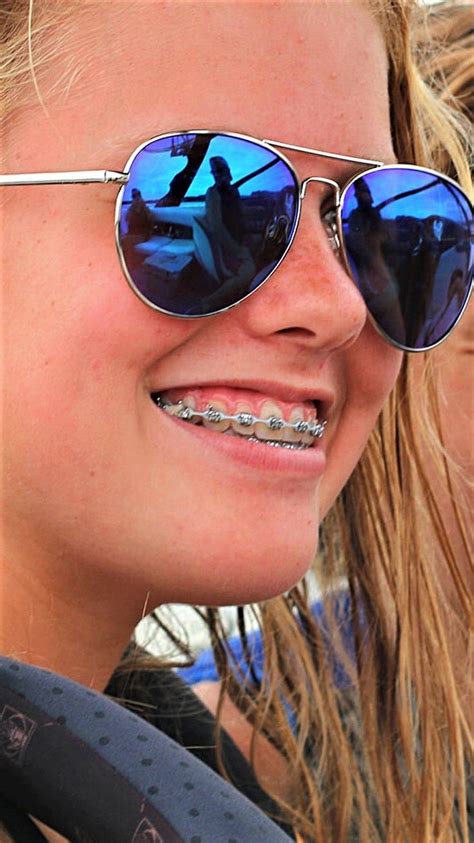 Pin By John Beeson On Girls In Braces Dental Braces Orthodontics