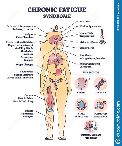 Chronic Fatigue Syndrome With Symptom And Risk Factors List Outline