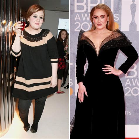 Did Adele Get Plastic Surgery See Her Transformation Photos Through