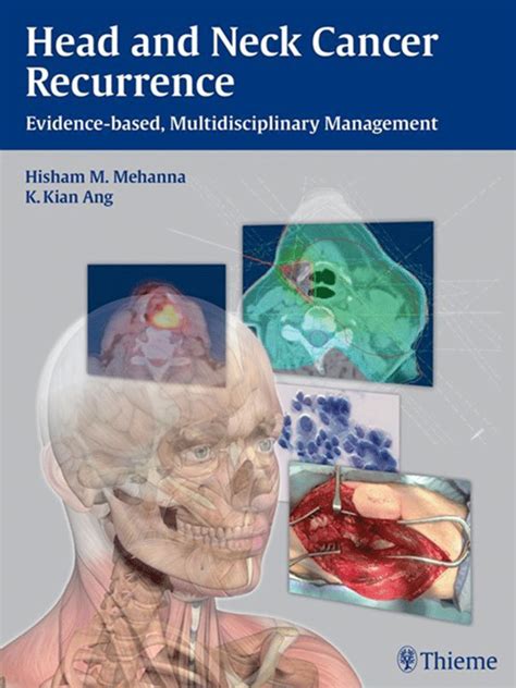 Head And Neck Cancer Recurrence Evidence Based Multidisciplinary