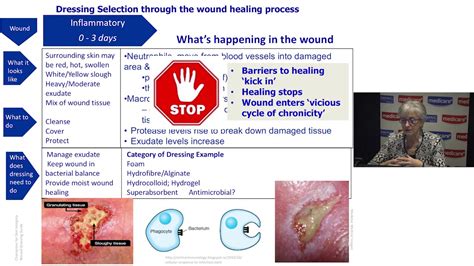 Understanding Wound Dressings Categories And Indications Slough