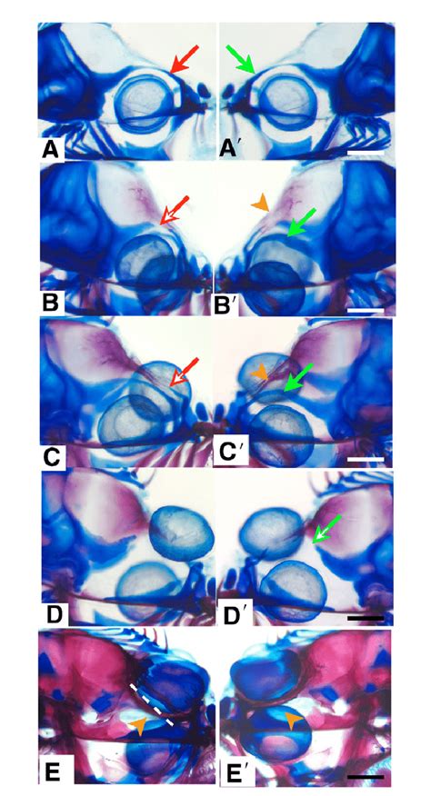 Remodeling Of Skull Bone Alizarin Red And Cartilage Alcian Blue