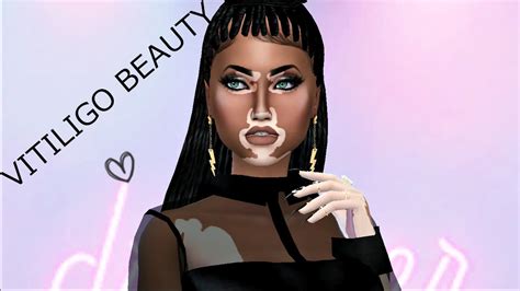 The Sims 4 Create A Sim Vitiligo Beauty 💞 Youtube