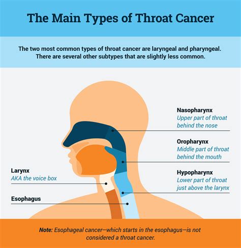 Throat Cancer Types Causes Symptoms Diagnosis Treatme