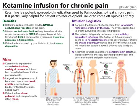 Ketamine Infusion For Chronic Pain By Dr Ming Kao Within Normal