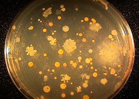 Growing Bacteria From Corals Smithsonian Ocean
