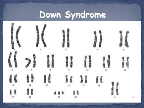 Ppt Pedigrees And Karyotypes Powerpoint Presentation Id5830826