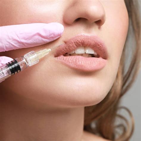 Where To Inject Botox For Lip Flip IAPAM