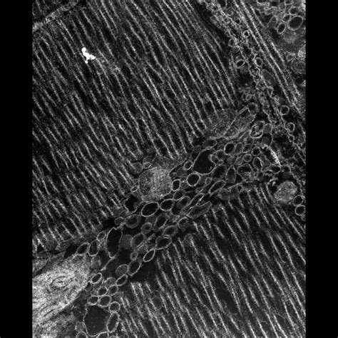 Cil37376 Damselfly Flight Muscle Cell Cil Dataset