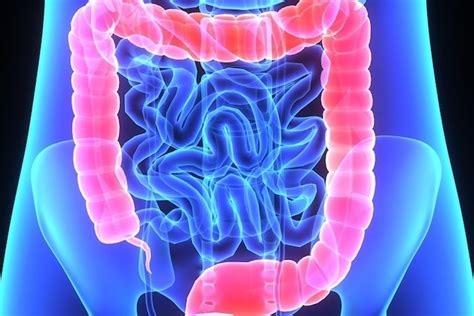 Candidiasis Symptoms Genital Throat Skin And Intestinal