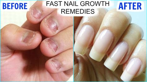 How To Grow Long Strong Nails Fast At Home Superprincessjo Youtube