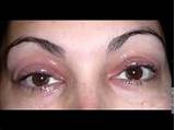 Images of Best Makeup For Eye Allergies
