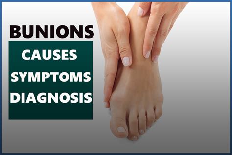 What Are Bunions Causes Symptoms And Diagnosis Dr Chetan Oswal