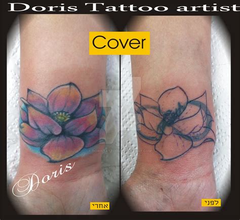 Lotus Cover Up Tattoo By Doristattoo On Deviantart
