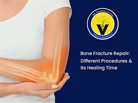 Bone Fracture Repair Surgery Healing Time Dr Vasudeva