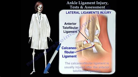 All concussions involve a traumatic impact to the head accompanied by either loss of consciousness (loc), alteration of consciousness,post traumatic amnesia or focal neurological if you or loved one are suspicious of having a concussion, make an appointment for professional evaluation right away. Ankle Ligament Injury Tests & Assessment - Everything You ...