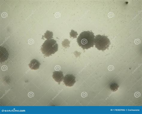 Round Shaped Candida Albicans Colonies Under The Microscope Stock Photo