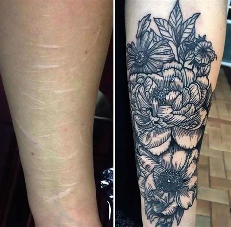 10 Scar Covering Tattoos With Amazing Stories Behind Them Bored Panda