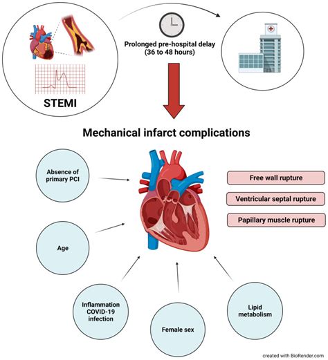 Mechanical Complications After Stemi Another Collateral Damage Of The