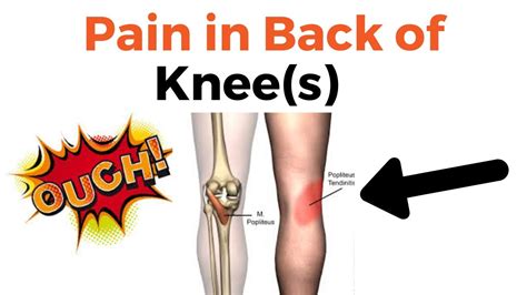 Pain In Back Of Knee After Walking Or Sitting Too Long Back Of Knee