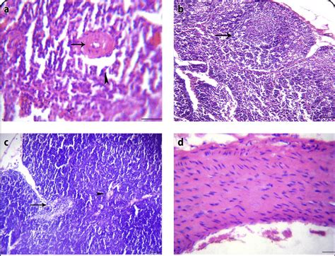 Clonazepam Treated Stressed Rat Group Iv A Spleen Section Showing