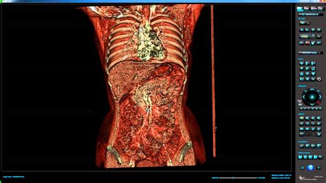 Human Body Revealed In Full By New Digital Autopsy Scanner Youtube