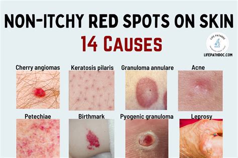Red Spots On Skin Not Itchy 17 Causes Treatments Home