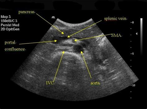 Longitudinal View Of Pancreas Website Has Abdominal Protocol And