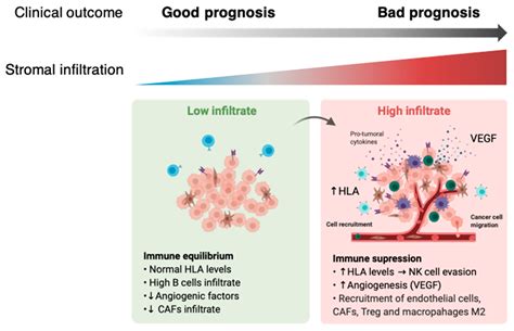 Ijms Free Full Text Additive Role Of Immune System Infiltration And