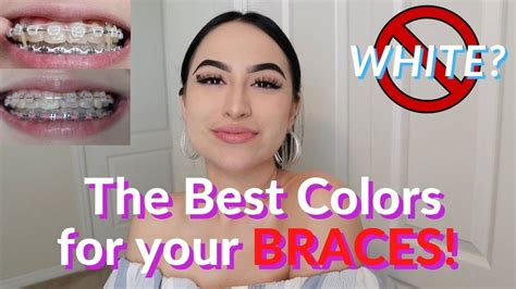 Braces Choose The Best Colors For Your Skin Tone And Teeth Color Youtube