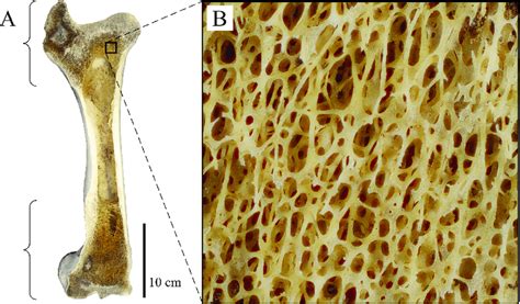 Cancellous Bone Occurrence And Macrostructure As