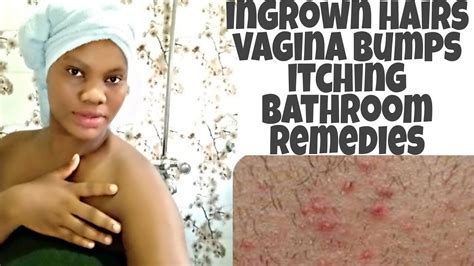 How To Stop Ingrown Hairs Itching And Vaginl Bumps From Shaving And Waxing Shaving Tips For