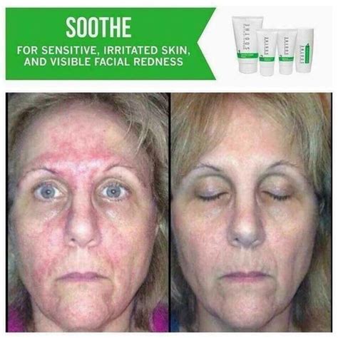 Soothe For Reducing Redness Rosacea Skin Care Rodan And Fields