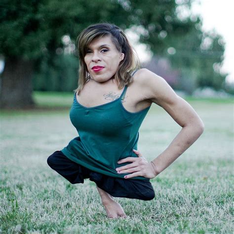 Trans Woman Born With Half A Body Finds Love Born With Half A Body
