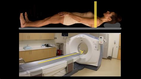 Anatomy Of CT Scans Introduction YouTube