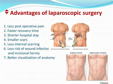 Ppt Basic Principles Of Laparoscopic Surgery Powerpoint Presentation