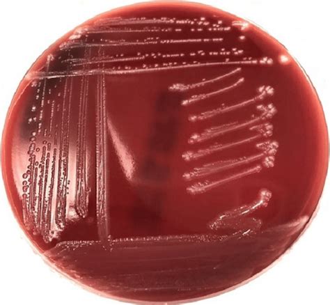 Colony Morphology Of Streptococcus Agalactiae Blood Agar 24 H At 37 °c
