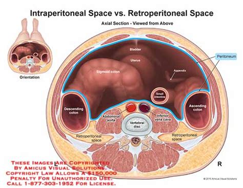 1508401a Intraperitoneal Space V Retroperitoneal Space Anatomy